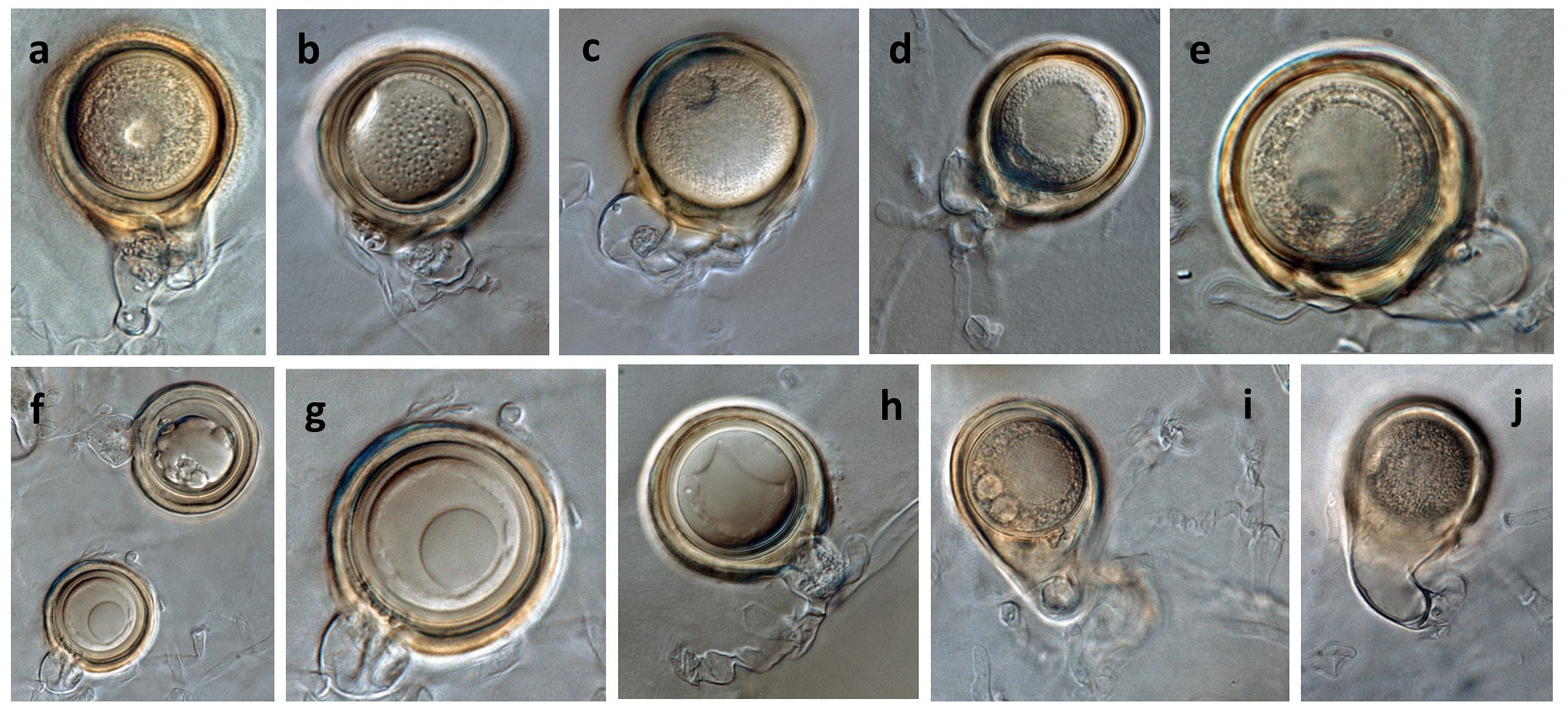   Phytophthora ideai  (ex-type CPHST BL 38) sexual phase: (andash;j) oogonia smooth-walled and sometimes pigmented when mature, sometimes with tapered bases (a, c, i, j) and often comma-shaped (i, j); antheridia predominantly paragynous, commonly attached near the oogonial stalk (andash;i), and sometimes amphyginous (fndash;h); oospores plerotic (c, g) and aplerotic (a, b, h); photos by Gloria Abad, USDA-APHIS-PPQ. 
